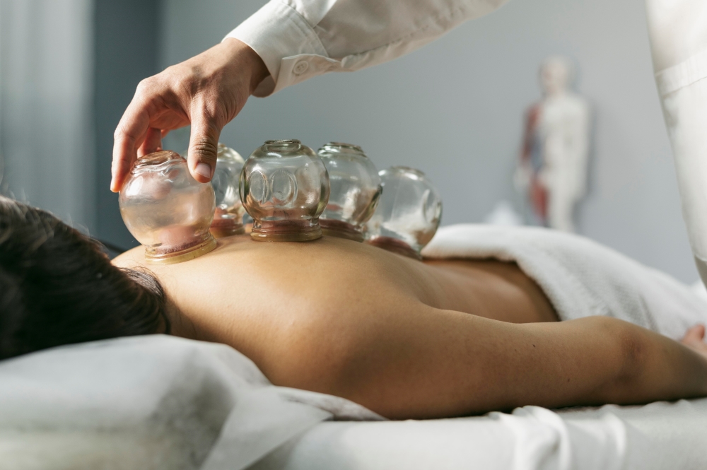 cupping therapy treatment